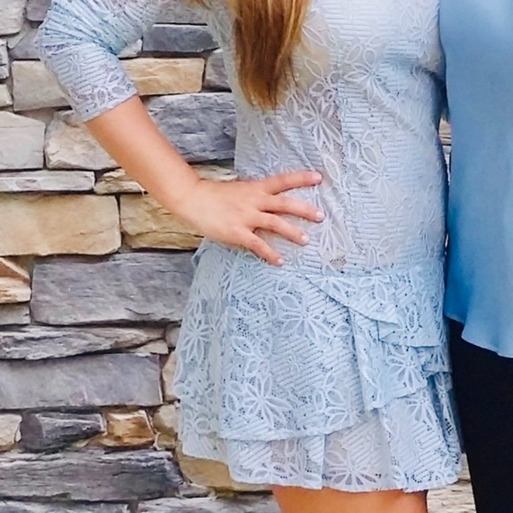 BCBG MaxAzria Baby Blue Lace Dress - Picture 3 of 6